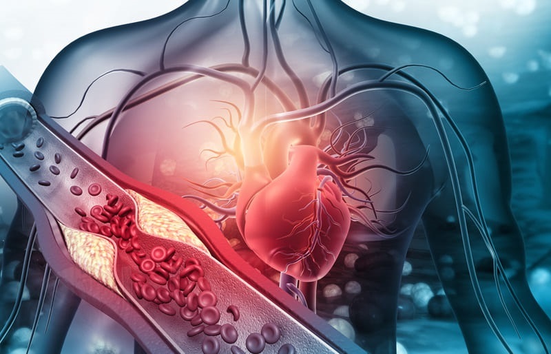 Image: The new tool can reclassify heart risk and reduce heart attacks (Photo courtesy of Adobe Stock)